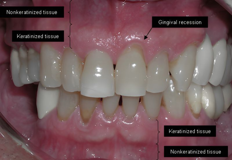 File:FA6-Image1.jpg